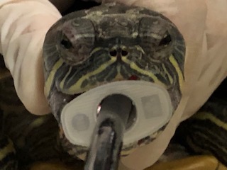 内視鏡検査（胃カメラ）