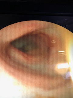 内視鏡検査（胃カメラ）