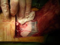 泌尿器・生殖器科 手術