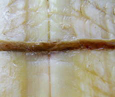 泌尿器・生殖器科 　甲羅の再生