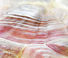 代謝性骨疾患（低カルシウム血症）